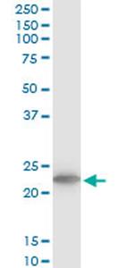 TPT1 Antibody in Western Blot (WB)