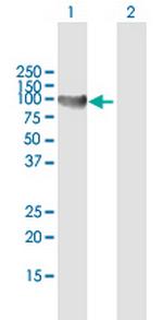 TTK Antibody in Western Blot (WB)