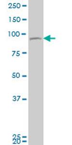 TTK Antibody in Western Blot (WB)