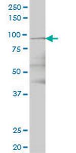 TTK Antibody in Western Blot (WB)