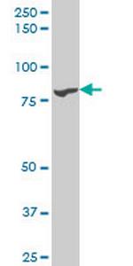 TTK Antibody in Western Blot (WB)