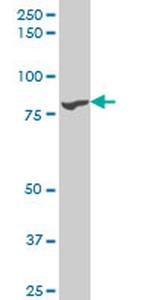 TTK Antibody in Western Blot (WB)