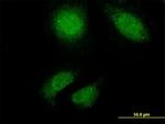 TTN Antibody in Immunocytochemistry (ICC/IF)