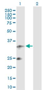 UQCRFS1 Antibody in Western Blot (WB)