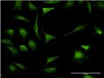 XBP1 Antibody in Immunocytochemistry (ICC/IF)