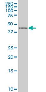 ZNF24 Antibody in Western Blot (WB)