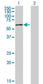 ZNF165 Antibody in Western Blot (WB)