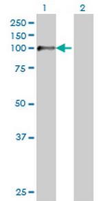 ZP2 Antibody in Western Blot (WB)