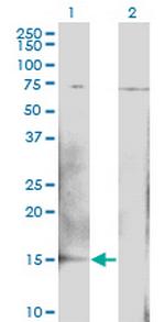 BTG2 Antibody in Western Blot (WB)