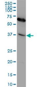 CXCR4 Antibody in Western Blot (WB)