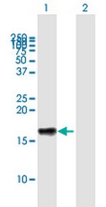 LST1 Antibody in Western Blot (WB)