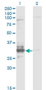 TFPI2 Antibody in Western Blot (WB)