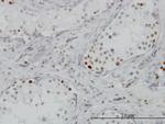 BRD3 Antibody in Immunohistochemistry (Paraffin) (IHC (P))