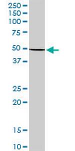 KRT36 Antibody in Western Blot (WB)