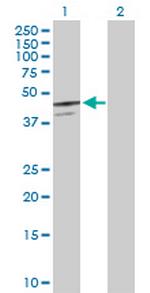 SERPINB7 Antibody in Western Blot (WB)