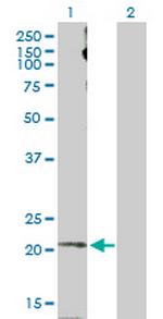 APLN Antibody in Western Blot (WB)