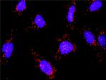 MAP3K14 Antibody in Proximity Ligation Assay (PLA) (PLA)