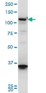 HIP1R Antibody in Western Blot (WB)