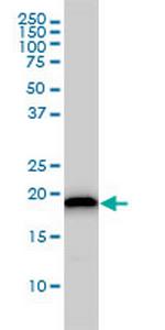 UBE2M Antibody in Western Blot (WB)