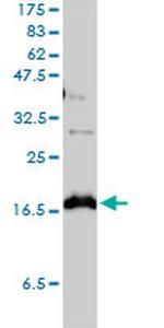 CLDN1 Antibody in Western Blot (WB)