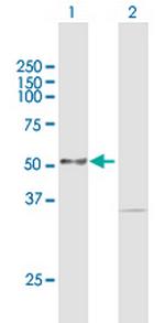 PKMYT1 Antibody in Western Blot (WB)