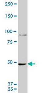 MTA1 Antibody in Western Blot (WB)