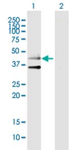 HTR3B Antibody in Western Blot (WB)