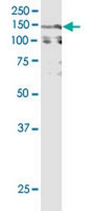 CACNA2D2 Antibody in Western Blot (WB)