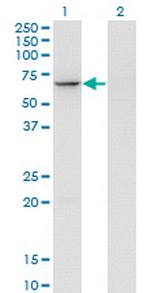 GTF3C5 Antibody in Western Blot (WB)