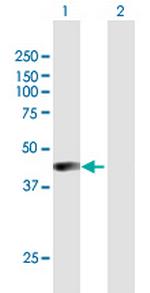 AIM2 Antibody in Western Blot (WB)