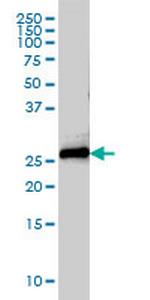 STX8 Antibody in Western Blot (WB)