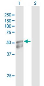 GAL3ST1 Antibody in Western Blot (WB)