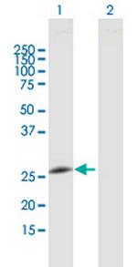 GOSR2 Antibody in Western Blot (WB)