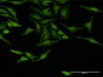 TRAF4 Antibody in Immunocytochemistry (ICC/IF)