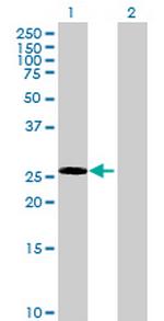 ECE2 Antibody in Western Blot (WB)