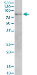 MFN2 Antibody in Western Blot (WB)