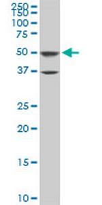 ROD1 Antibody in Western Blot (WB)