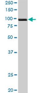 PDCD6IP Antibody in Western Blot (WB)