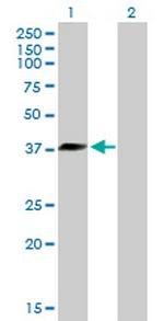 DNAJB6 Antibody in Western Blot (WB)