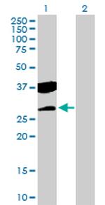 CTDSP2 Antibody in Western Blot (WB)