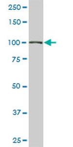 TRIM28 Antibody in Western Blot (WB)