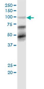 TRIM28 Antibody in Western Blot (WB)