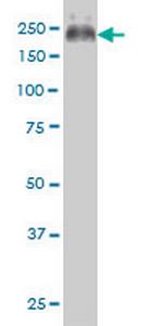 ABCC4 Antibody in Western Blot (WB)