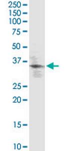 KLF2 Antibody in Western Blot (WB)