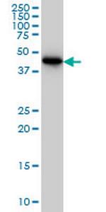 CRTAP Antibody in Western Blot (WB)