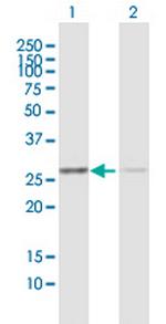 ANP32B Antibody in Western Blot (WB)