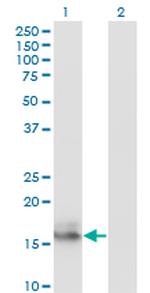 AGR2 Antibody in Western Blot (WB)