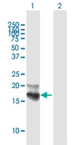 NPC2 Antibody in Western Blot (WB)