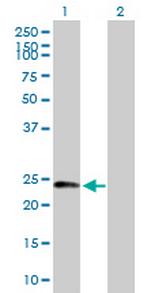 DCTN6 Antibody in Western Blot (WB)