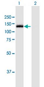 MGEA5 Antibody in Western Blot (WB)